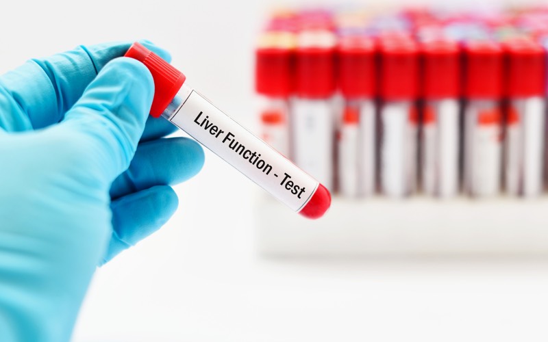 Liver Health - MyLabZone